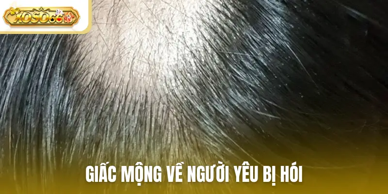 Giấc mộng về người yêu bị hói